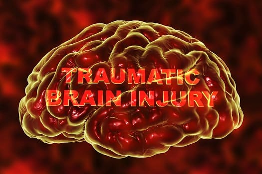 Understanding TBI in Older Adults in Ambience, TX